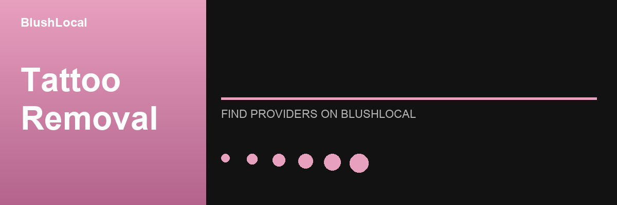 Tattoo Removal treatments and providers